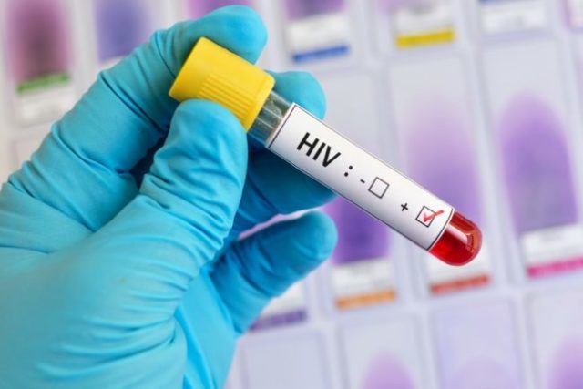 U Srbiji virusom HIV-a inficirano više od 3.500 ljudi