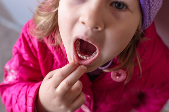 Šta izaziva afte u ustima i kako ih lečiti