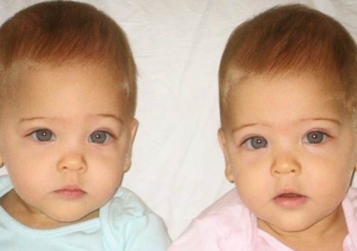 Evo kako najlepše bliznakinje na svetu danas izgledaju
