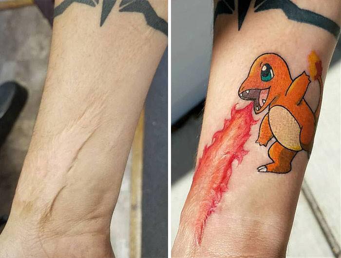 Kad ožiljci prerastu u tetovaže – dobiju se remek-dela!