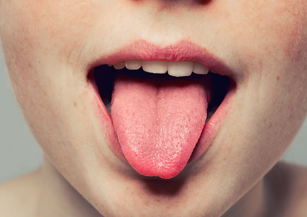 Postoji nekoliko verovanja – šta znači kada se ugrizete za jezik?