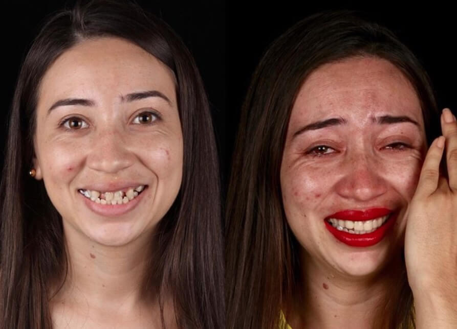 Brazilski zubar vraća ljudima osmeh na lice