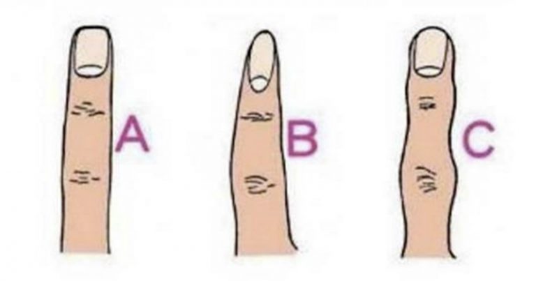 Oblik vašeg prsta otkriva kakva ste osoba