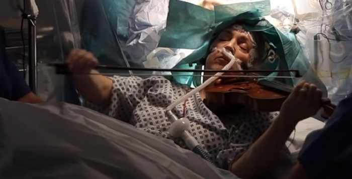 Pacijentkinja usred operacije tumora na mozgu zasvirala violinu!