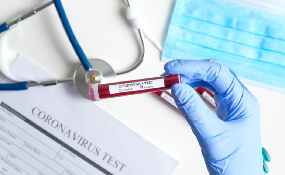 Od danas u Srbiji test samoprocene na koronavirus