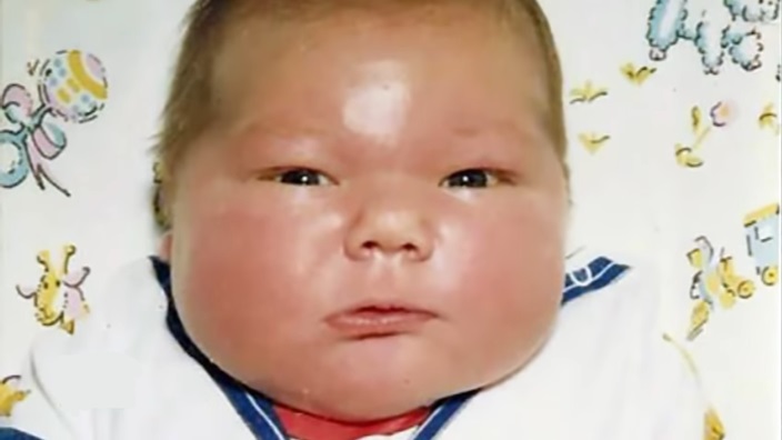 Ogromna beba teška 7.3 kg bila je senzacija 1983. godine – evo kako danas izgleda