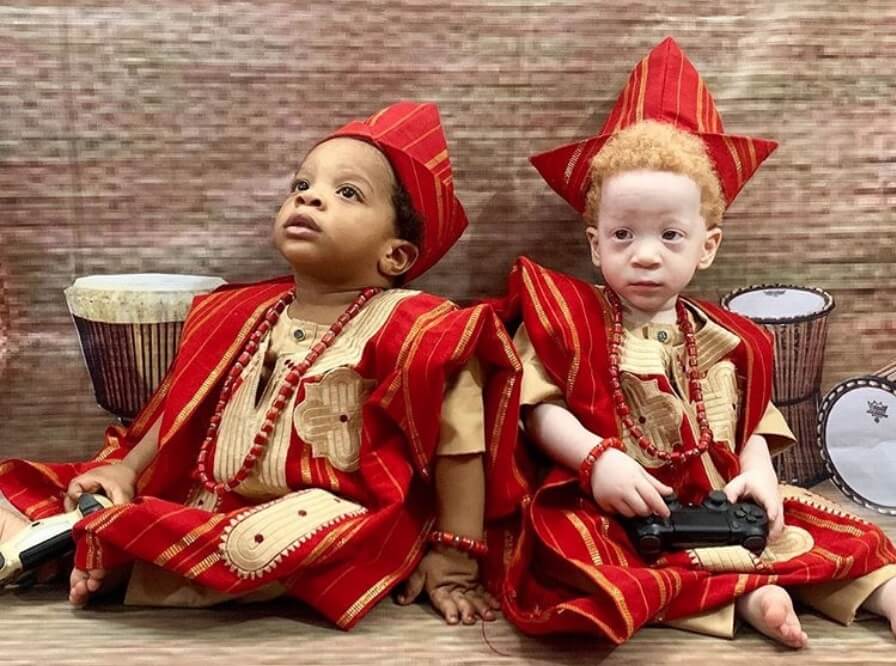 Preslatki blizanci rođeni s različitom bojom kože postali zvezde