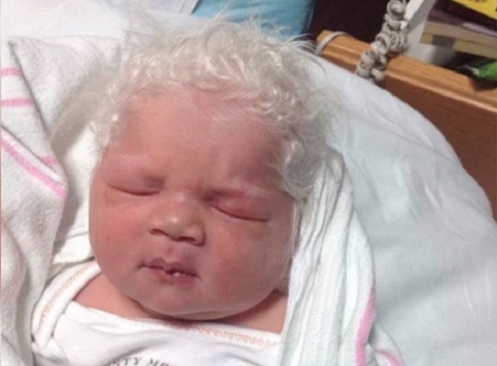 Medicinski fenomen – Ova beba ima belu kosu, ali nema albinizam!
